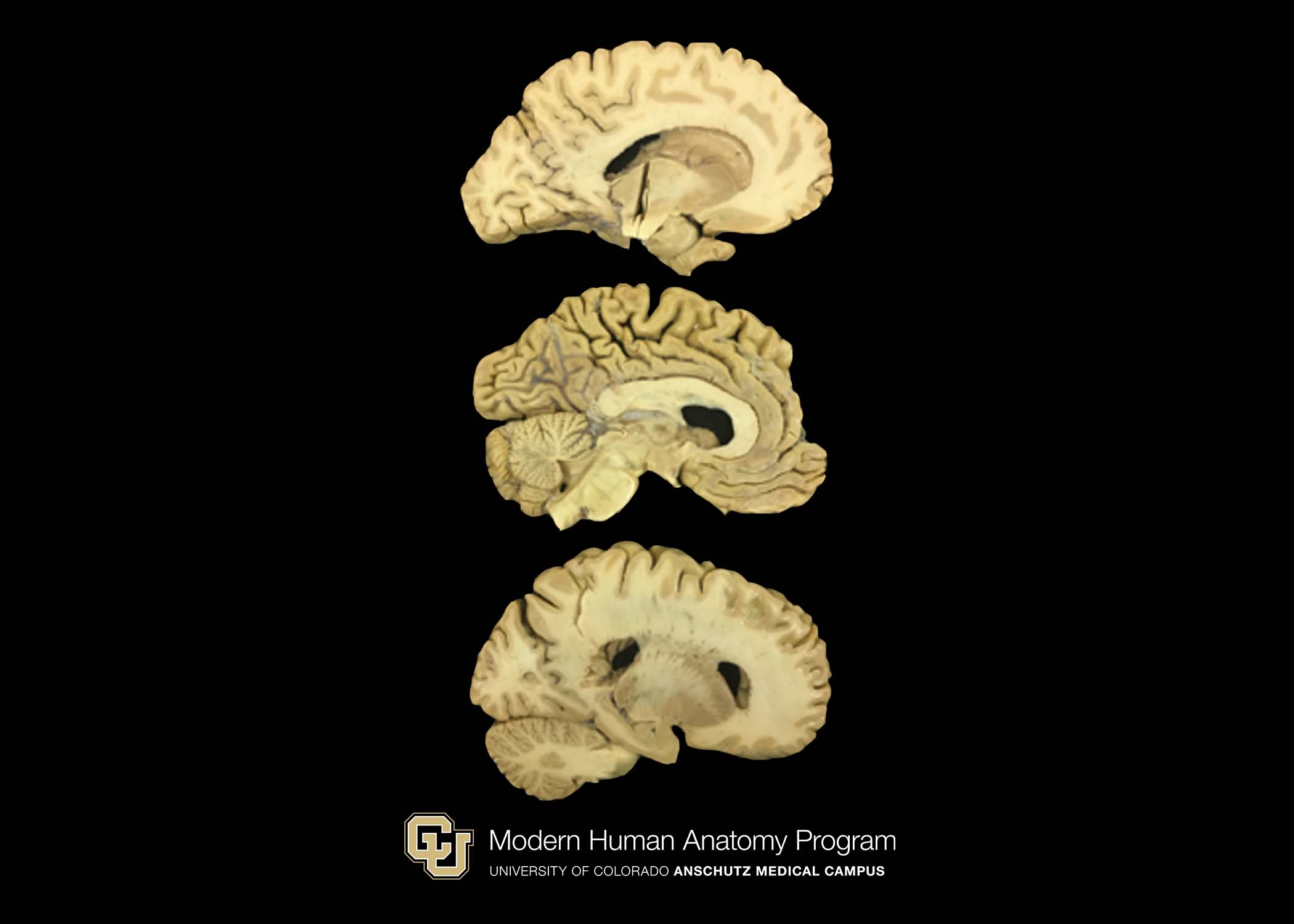 CU Plastinated Organ Library